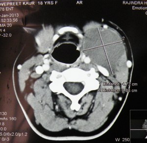 branchial CT