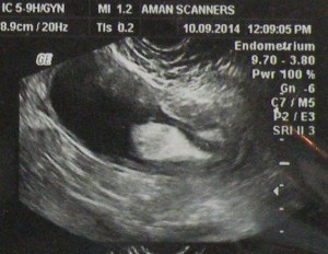 ???????????????????????????????