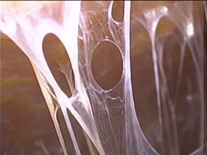 violin-string adhesions 19.9.15a