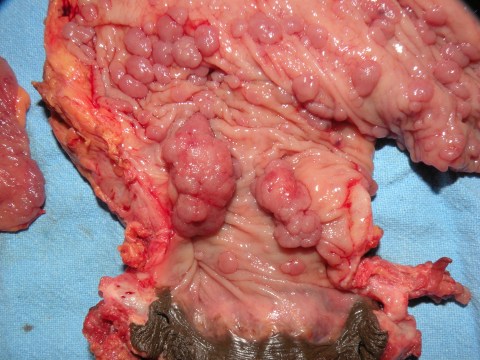 FAP 14.5.16g rectum and anus