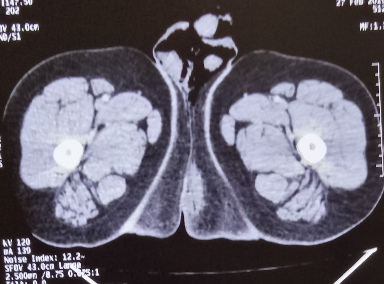 fourniere's 13.4.19e