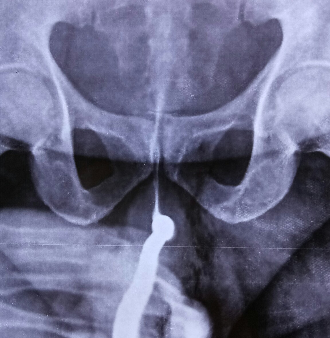 fourniere's 13.4.19f